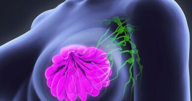 Mulheres na pós-menopausa com câncer de mama podem evitar quimioterapia
