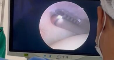 Hospital Estadual do Centro-Norte Goiano realiza primeira cirurgia com alta tecnologia por vídeo