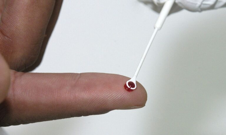 Brasil | HIV | PrEP